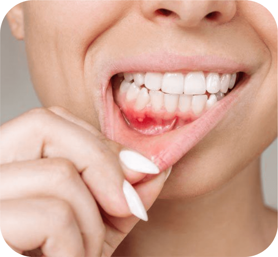 Periodontics