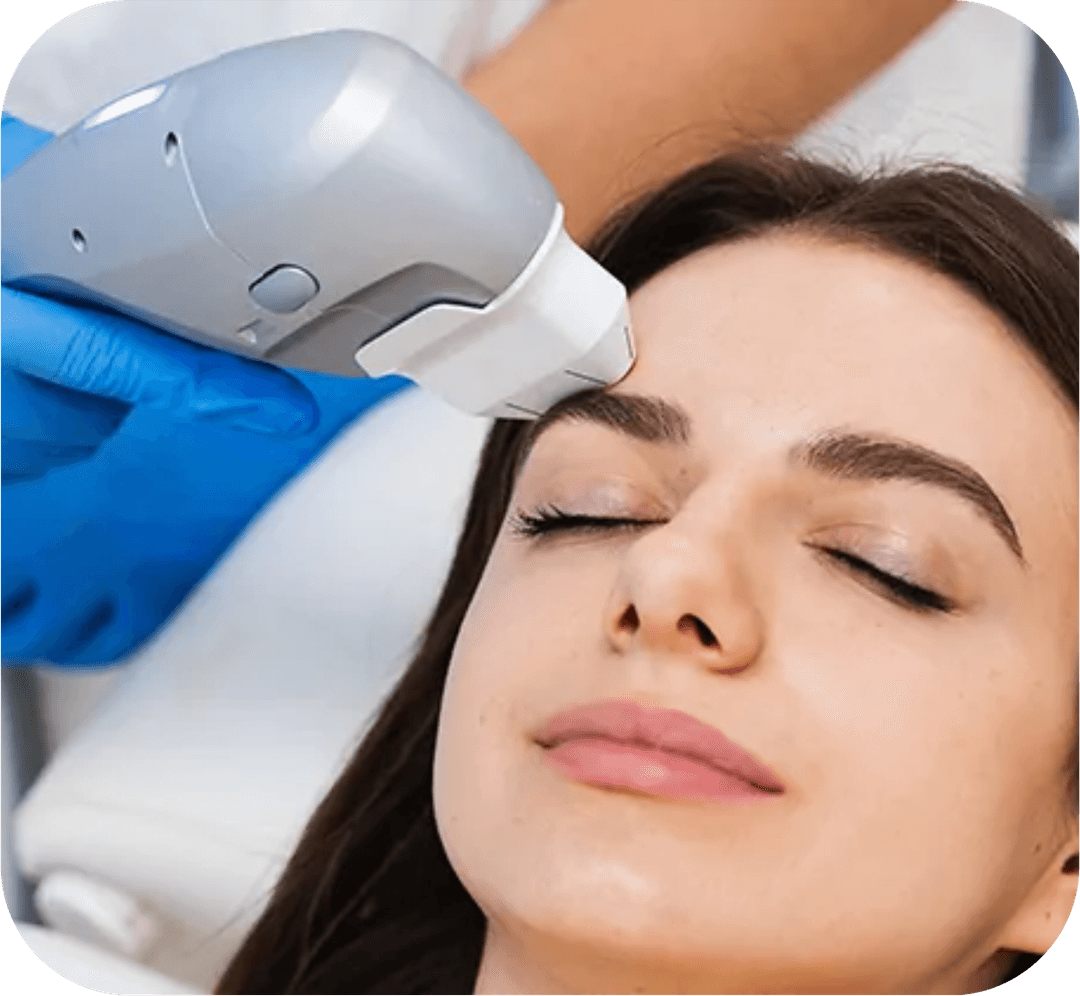 Laser Treatments